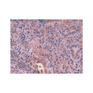 Cytokeratin 8 Antibody,Cytokeratin 8 Antibody