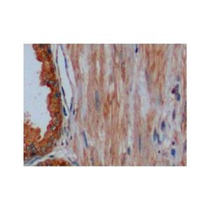 Cytokeratin 8 Antibody,Cytokeratin 8 Antibody