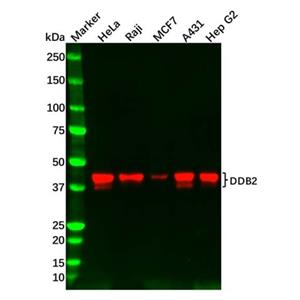 aladdin 阿拉丁 Ab099353 Recombinant DDB2 Antibody Recombinant (R09-1D5); Rabbit anti Human DDB2 Antibody; WB; Unconjugated