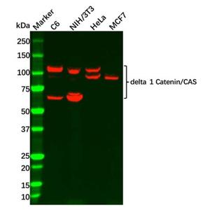 aladdin 阿拉丁 Ab099575 Recombinant delta 1 Catenin/CAS Antibody Recombinant (R01-4G3); Rabbit anti Human delta 1 Catenin/CAS Antibody; WB, IHC; Unconjugated