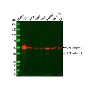 Recombinant DP1 Antibody,Recombinant DP1 Antibody