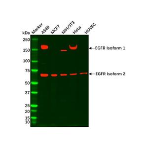 aladdin 阿拉丁 Ab101163 EGFR Mouse mAb mAb(C4); Mouse anti Human EGFR Antibody; WB, IHC; Unconjugated