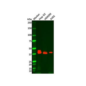 aladdin 阿拉丁 Ab101839 Recombinant EpCAM Antibody Recombinant (RR694); Rabbit anti Human EpCAM Antibody; WB, IHC, Flow, IP; Unconjugated