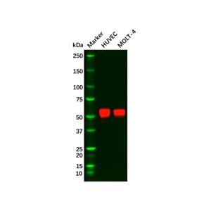 aladdin 阿拉丁 Ab102175 Recombinant ERG Antibody Recombinant (R09-9J7); Rabbit anti Human ERG Antibody; WB, IHC; Unconjugated