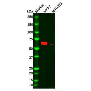 aladdin 阿拉丁 Ab102356 Recombinant Estrogen Receptor alpha Antibody Recombinant (R05-1E4); Rabbit anti Human Estrogen Receptor alpha Antibody; WB, IHC, ICC, IF; Unconjugated