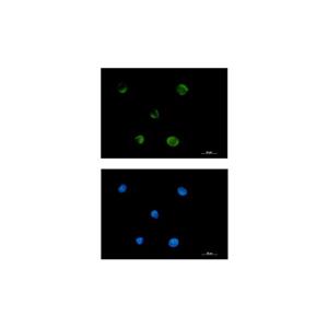 Recombinant FADS1 Antibody,Recombinant FADS1 Antibody