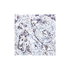 Recombinant FADS1 Antibody,Recombinant FADS1 Antibody