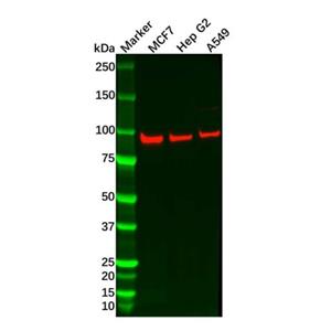 aladdin 阿拉丁 Ab103180 FER Mouse mAb mAb (1457CT181.12.17); Mouse anti Human FER Antibody; WB, IHC; Unconjugated 