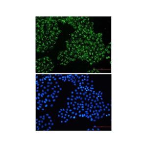 Recombinant FGFR3 Antibody,Recombinant FGFR3 Antibody