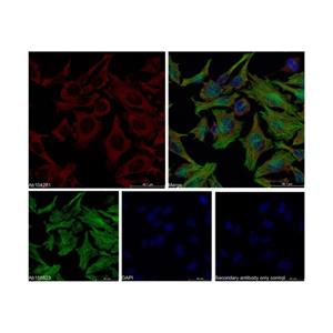 Recombinant FXR1 Antibody,Recombinant FXR1 Antibody