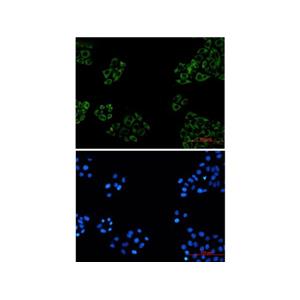 Recombinant FXR1 Antibody,Recombinant FXR1 Antibody