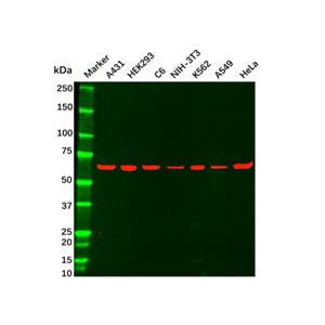 aladdin 阿拉丁 Ab104334 Recombinant G3BP Antibody Recombinant (R06-5D2); Rabbit anti Human G3BP Antibody; WB, ICC, IF, IHC; Unconjugated