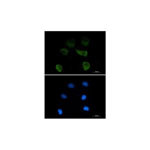 Recombinant gamma Tubulin Antibody,Recombinant gamma Tubulin Antibody