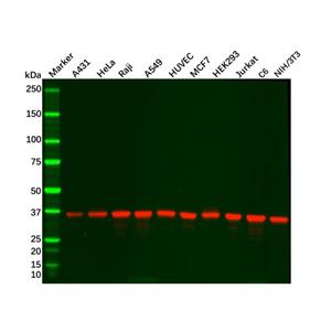 aladdin 阿拉丁 Ab104788 Recombinant GAPDH Antibody Recombinant (RR688); Rabbit anti Human GAPDH Antibody; WB, IHC, Flow, IF, ICC, IP; Unconjugated