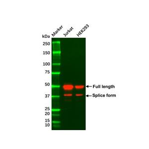 Recombinant GATA3 Antibody,Recombinant GATA3 Antibody