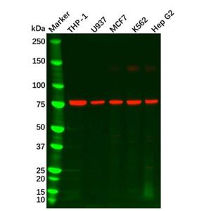 aladdin 阿拉丁 Ab105080 GCSF Receptor Antibody pAb; Rabbit anti Human GCSF Receptor Antibody; WB, IHC, ICC/IF ; Unconjugated