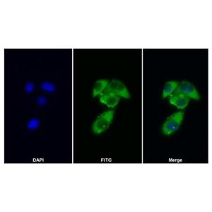 GCSF Receptor Antibody,GCSF Receptor Antibody