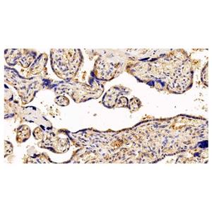 GCSF Receptor Antibody,GCSF Receptor Antibody