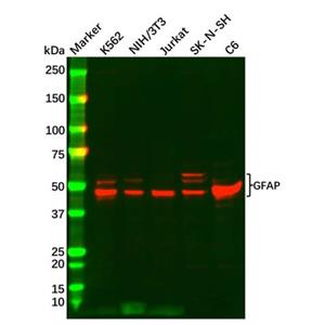aladdin 阿拉丁 Ab105229 GFAP Antibody pAb; Rabbit anti Human GFAP Antibody; WB, IHC; Unconjugated