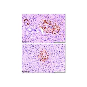 aladdin 阿拉丁 Ab105544 Recombinant Glucagon Antibody Recombinant (EP3070); Rabbit anti Human Glucagon Antibody; IHC; Unconjugated