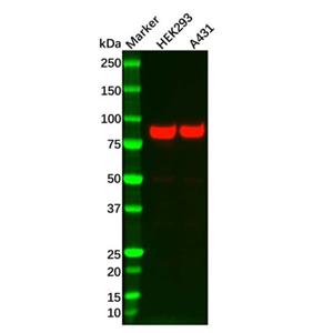 aladdin 阿拉丁 Ab105776 Recombinant Glycogen synthase 1/GYS1 Antibody Recombinant (R02-2F3); Rabbit anti Human Glycogen synthase 1/GYS1  Antibody; WB, IF, ICC; Unconjugated