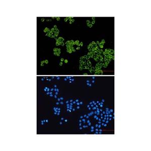 Recombinant Glycogen synthase 1/GYS1 Antibody,Recombinant Glycogen synthase 1/GYS1 Antibody