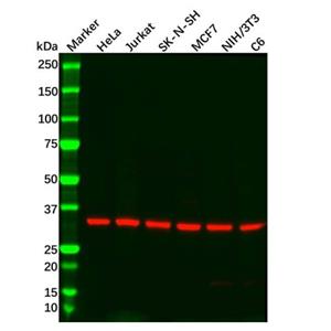 aladdin 阿拉丁 Ab105941 Recombinant GNB2 Antibody Recombinant (R04-1A2); Rabbit anti Human GNB2 Antibody; WB, IHC; Unconjugated