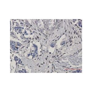 Recombinant GNB2 Antibody,Recombinant GNB2 Antibody