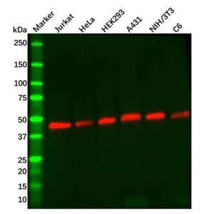 aladdin 阿拉丁 Ab106628 Recombinant GSK3 beta Antibody Recombinant (R09-7G8); Rabbit anti Human GSK3 beta Antibody; WB, IHC; Unconjugated