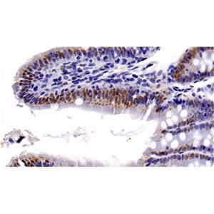 HDAC1 Mouse mAb,HDAC1 Mouse mAb