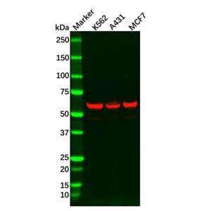 aladdin 阿拉丁 Ab107031 Recombinant HDAC2 Antibody Recombinant (R06-4E4); Rabbit anti Human HDAC2 Antibody; WB, IHC, IF, ICC; Unconjugated