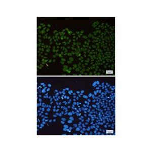 Recombinant HDAC2 Antibody,Recombinant HDAC2 Antibody