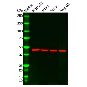 aladdin 阿拉丁 Ab109347 IDH2 Antibody pAb; Rabbit anti Human IDH2 Antibody; WB, IHC; Unconjugated
