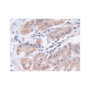 IDH2 Antibody,IDH2 Antibody