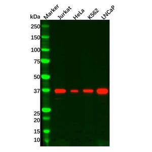aladdin 阿拉丁 Ab109691 Recombinant IKB alpha Antibody Recombinant (R06-9E9); Rabbit anti Human IKB alpha Antibody; WB; Unconjugated