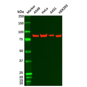 aladdin 阿拉丁 Ab109731 Recombinant IKK beta Antibody Recombinant (R01-9H6); Rabbit anti Human IKK Beta Antibody; WB, ICC, IF; Unconjugated