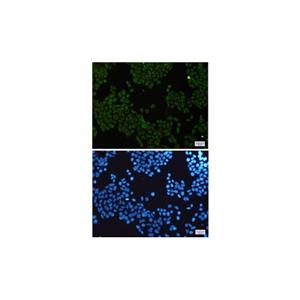 Recombinant IKK Gamma/NEMO Antibody,Recombinant IKK Gamma/NEMO Antibody