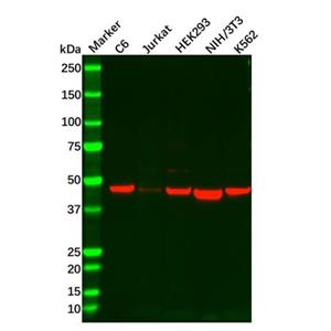 aladdin 阿拉丁 Ab109850 Recombinant IL-11RA Antibody Recombinant (R08-2J3); Rabbit anti Human IL-11RA Antibody; WB, IHC; Unconjugated