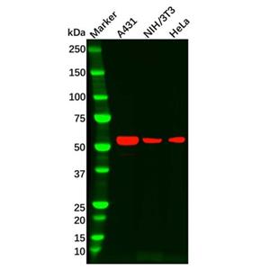 aladdin 阿拉丁 Ab109915 IL-13 receptor alpha 1 Antibody pAb; Rabbit anti Human IL-13 receptor alpha 1 Antibody; WB, IHC; Unconjugated