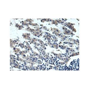 IL-13 receptor alpha 1 Antibody,IL-13 receptor alpha 1 Antibody