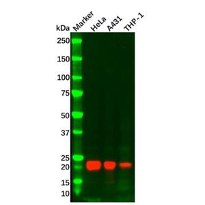 aladdin 阿拉丁 Ab110010 IL-18 Mouse mAb mAb (C10); Mouse anti Human IL-18 Antibody; WB, IHC; Unconjugated
