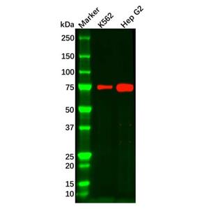 aladdin 阿拉丁 Ab110168 IL22RA1 Antibody pAb; Rabbit anti Human IL22RA1 Antibody; WB; Unconjugated