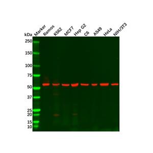 aladdin 阿拉丁 Ab110516 Recombinant IMPDH2 Antibody Recombinant (R06-1B8); Rabbit anti Human IMPDH2 Antibody; WB, IHC, ICC, IF; Unconjugated