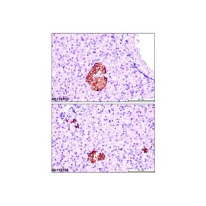 Recombinant Insulin Antibody,Recombinant Insulin Antibody