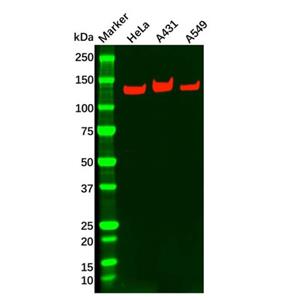 Integrin alpha 3 Antibody,Integrin alpha 3 Antibody