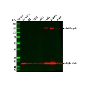 aladdin 阿拉丁 Ab110802 Recombinant Integrin alpha 5 Antibody Recombinant (R02-3G4); Rabbit anti Human Integrin alpha 5 Antibody; WB, IHC; Unconjugated