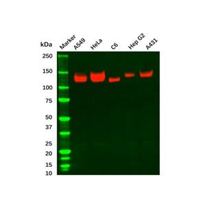 aladdin 阿拉丁 Ab110825 Recombinant Integrin alpha V Antibody Recombinant (R02-6G3); Rabbit anti Human Integrin Alpha V Antibody; WB, ICC, IF; Unconjugated
