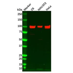 aladdin 阿拉丁 Ab110875 Recombinant Integrin beta 3 Antibody Recombinant (R02-5I9); Rabbit anti Human Integrin beta 3 Antibody; WB; Unconjugated