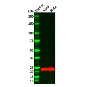 aladdin 阿拉丁 Ab110966 Recombinant Interferon beta Antibody Recombinant (R01-2I4); Rabbit anti Human Interferon beta Antibody; WB; Unconjugated