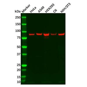 aladdin 阿拉丁 Ab111364 Recombinant ITGB6 Antibody Recombinant (R04-6E9); Rabbit anti Human ITGB6 Antibody; WB; Unconjugated